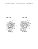 ADAPTIVE SPINAL ROD AND METHODS FOR STABILIZATION OF THE SPINE diagram and image