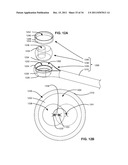 ADAPTIVE SPINAL ROD AND METHODS FOR STABILIZATION OF THE SPINE diagram and image