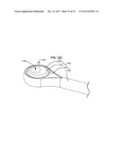 ADAPTIVE SPINAL ROD AND METHODS FOR STABILIZATION OF THE SPINE diagram and image