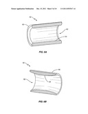 DYNAMIC SPINAL STABILIZATION ASSEMBLY WITH SLIDING COLLARS diagram and image