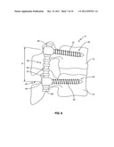 DYNAMIC SPINAL STABILIZATION ASSEMBLY WITH SLIDING COLLARS diagram and image