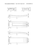 System for Treating Bone Fractures diagram and image