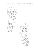 System for Treating Bone Fractures diagram and image