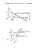 System for Treating Bone Fractures diagram and image