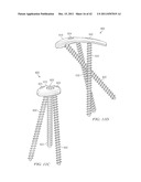 System for Treating Bone Fractures diagram and image