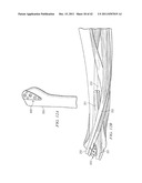 System for Treating Bone Fractures diagram and image