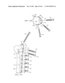 System for Treating Bone Fractures diagram and image