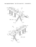 System for Treating Bone Fractures diagram and image