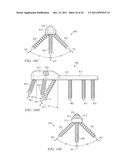 System for Treating Bone Fractures diagram and image