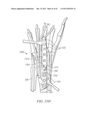 System for Treating Bone Fractures diagram and image