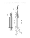 METHODS AND SYSTEMS FOR OSTIAL STENTING OF A BIFURCATION diagram and image