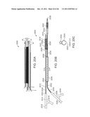 METHODS AND SYSTEMS FOR OSTIAL STENTING OF A BIFURCATION diagram and image