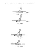 METHODS AND SYSTEMS FOR OSTIAL STENTING OF A BIFURCATION diagram and image