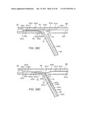 METHODS AND SYSTEMS FOR OSTIAL STENTING OF A BIFURCATION diagram and image