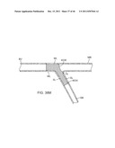 METHODS AND SYSTEMS FOR OSTIAL STENTING OF A BIFURCATION diagram and image