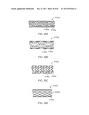 METHODS AND SYSTEMS FOR OSTIAL STENTING OF A BIFURCATION diagram and image