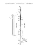 METHODS AND SYSTEMS FOR TREATING A BIFURCATION WITH PROVISIONAL SIDE     BRANCH STENTING diagram and image