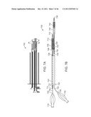 METHODS AND SYSTEMS FOR TREATING A BIFURCATION WITH PROVISIONAL SIDE     BRANCH STENTING diagram and image