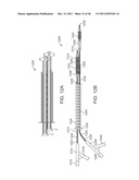 METHODS AND SYSTEMS FOR TREATING A BIFURCATION WITH PROVISIONAL SIDE     BRANCH STENTING diagram and image