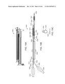 METHODS AND SYSTEMS FOR TREATING A BIFURCATION WITH PROVISIONAL SIDE     BRANCH STENTING diagram and image