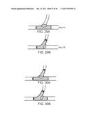 METHODS AND SYSTEMS FOR TREATING A BIFURCATION WITH PROVISIONAL SIDE     BRANCH STENTING diagram and image