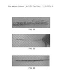 METHODS AND SYSTEMS FOR TREATING A BIFURCATION WITH PROVISIONAL SIDE     BRANCH STENTING diagram and image