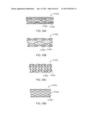 METHODS AND SYSTEMS FOR TREATING A BIFURCATION WITH PROVISIONAL SIDE     BRANCH STENTING diagram and image