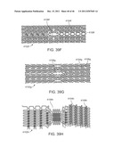 METHODS AND SYSTEMS FOR TREATING A BIFURCATION WITH PROVISIONAL SIDE     BRANCH STENTING diagram and image