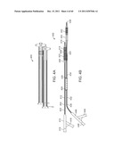 SELECTIVE STENT CRIMPING diagram and image