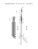 SELECTIVE STENT CRIMPING diagram and image