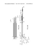 SELECTIVE STENT CRIMPING diagram and image