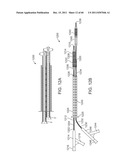 SELECTIVE STENT CRIMPING diagram and image