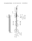 SELECTIVE STENT CRIMPING diagram and image