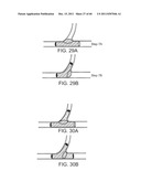 SELECTIVE STENT CRIMPING diagram and image