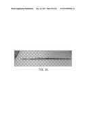 SELECTIVE STENT CRIMPING diagram and image