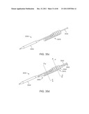 SELECTIVE STENT CRIMPING diagram and image