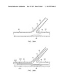 SELECTIVE STENT CRIMPING diagram and image