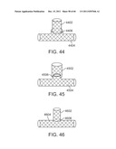 SELECTIVE STENT CRIMPING diagram and image