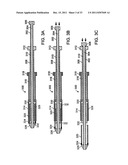 BI-DIRECTIONAL STENT DELIVERY SYSTEM diagram and image