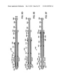 BI-DIRECTIONAL STENT DELIVERY SYSTEM diagram and image