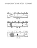 BI-DIRECTIONAL STENT DELIVERY SYSTEM diagram and image