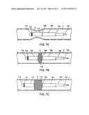 BI-DIRECTIONAL STENT DELIVERY SYSTEM diagram and image