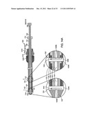 BI-DIRECTIONAL STENT DELIVERY SYSTEM diagram and image