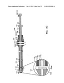 BI-DIRECTIONAL STENT DELIVERY SYSTEM diagram and image