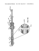 BI-DIRECTIONAL STENT DELIVERY SYSTEM diagram and image