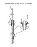 BI-DIRECTIONAL STENT DELIVERY SYSTEM diagram and image