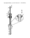 BI-DIRECTIONAL STENT DELIVERY SYSTEM diagram and image