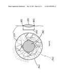 ACCOMMODATIVE INTRAOCULAR LENS AND METHOD OF IMPROVING ACCOMMODATION diagram and image