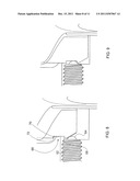 TRIAL FEMORAL PROSTHESIS AND ITS USE diagram and image