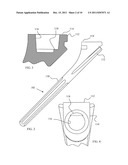 Joint Prosthesis with Positionable Head diagram and image